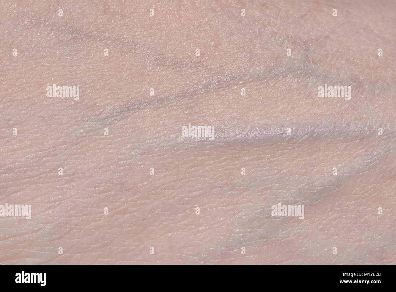Veins woman -Fotos und -Bildmaterial in hoher Auflösung – Alamy