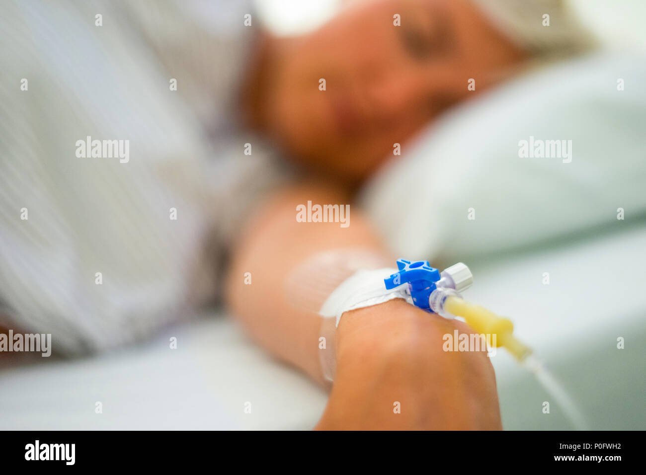 Peripher-venösen Katheter in der Hand des jungen kaukasischen Frau Stockfoto
