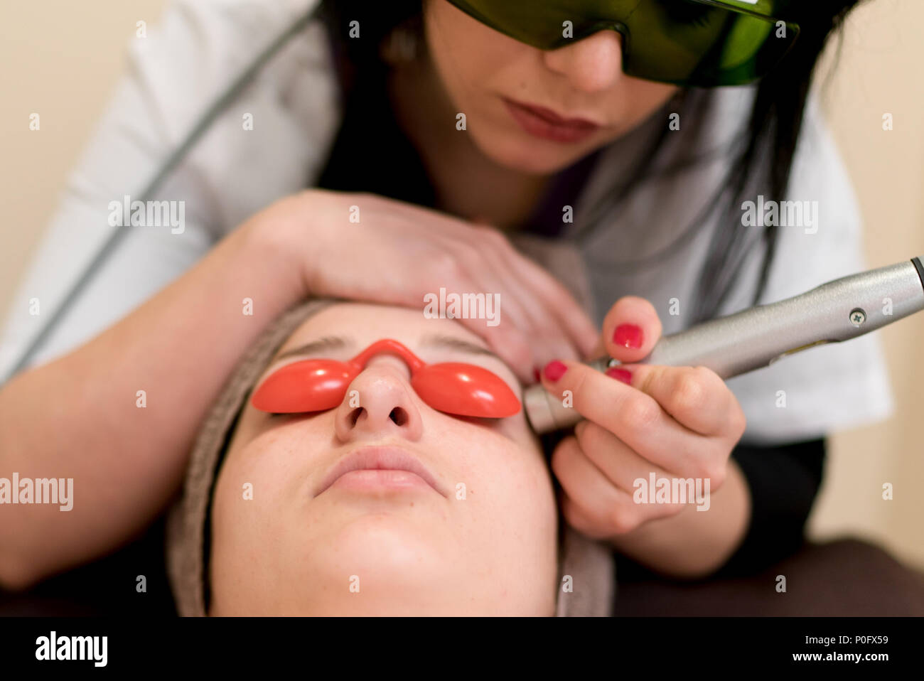 Verona, Italien - 14. März 2016: Laser Behandlung der Gesichtshaut Unvollkommenheiten in einen Schönheitssalon zu entfernen. Stockfoto