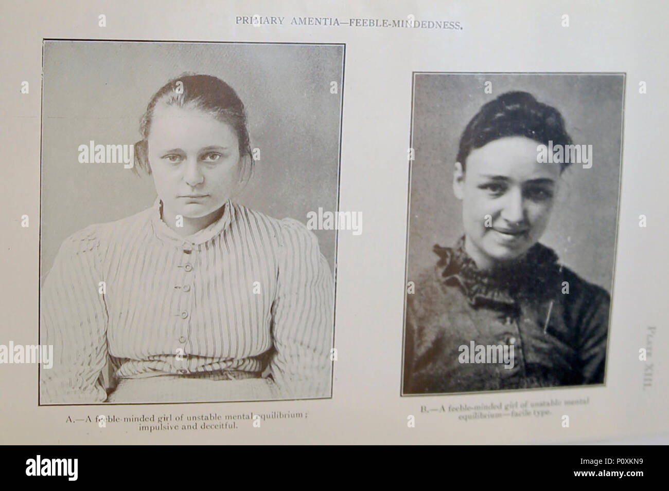 'MENTALE MANGEL" (Amentia), fünfte Auflage, 1929... IMG 3569 bearbeitet-13. Stockfoto