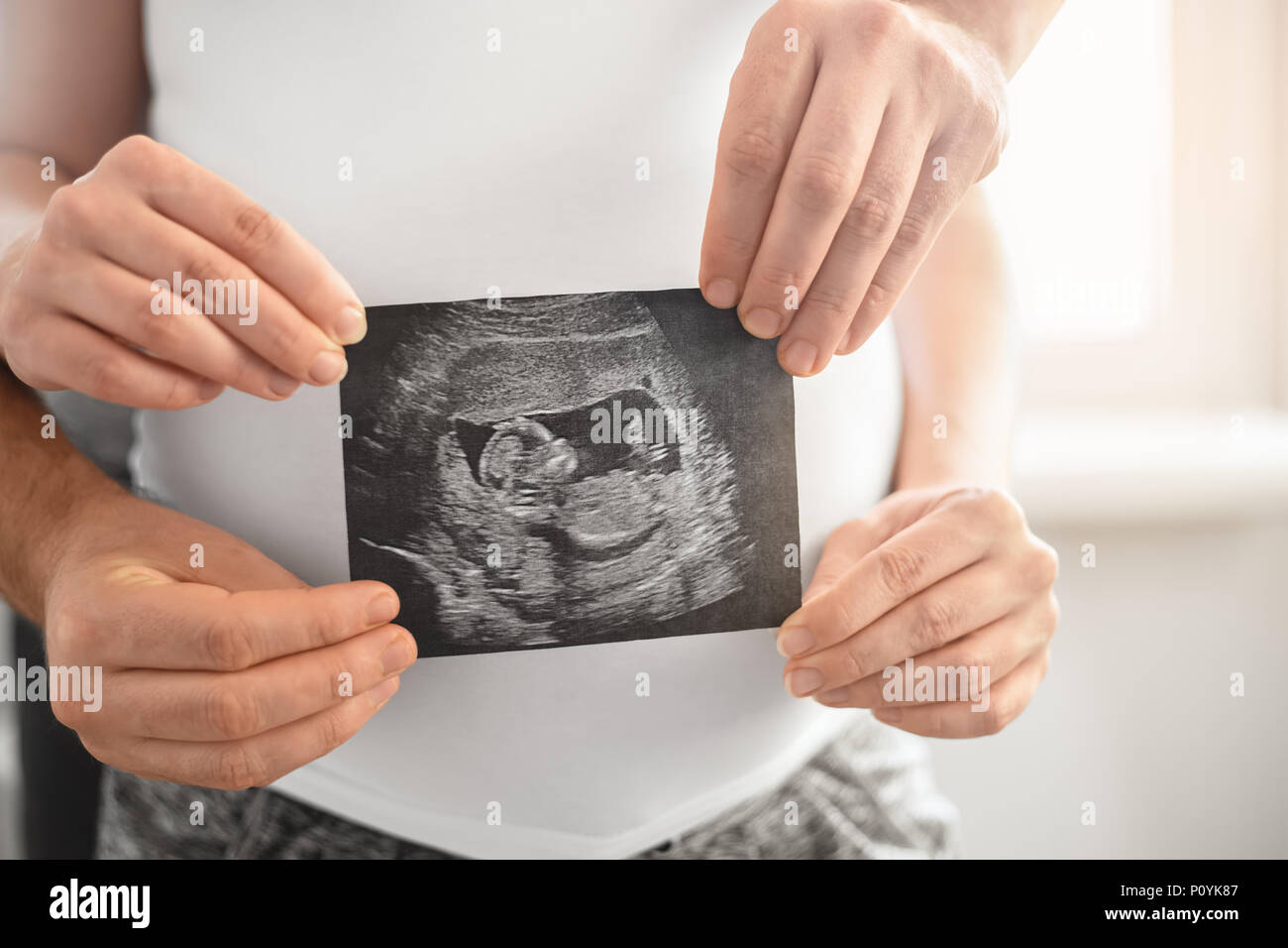 Closeup schwangere Paar hält Ultraschallbild Ihres Babys Stockfoto