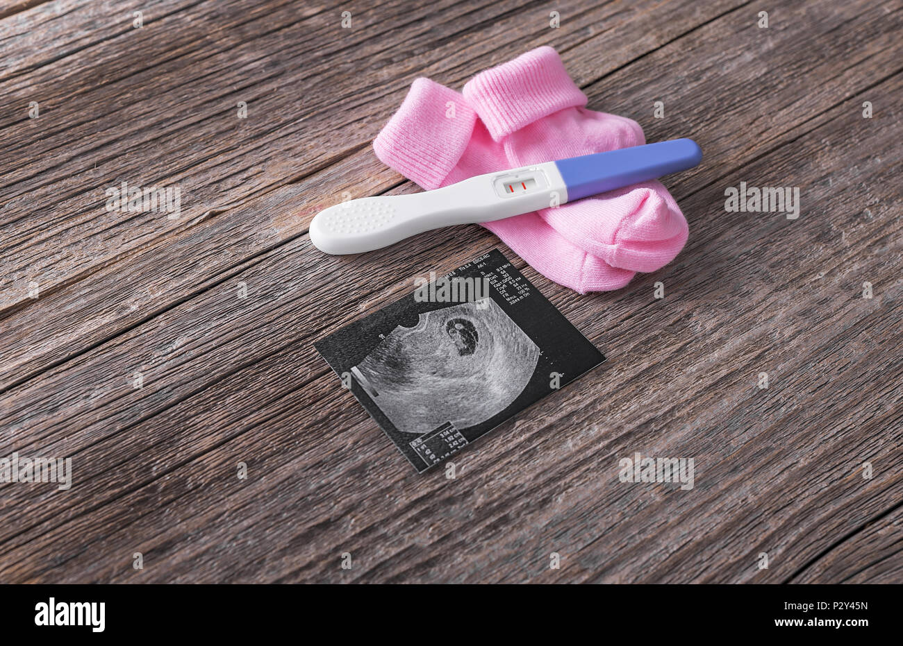 Schwangerschaft und Baby Socken Bild des Embryos. Stockfoto