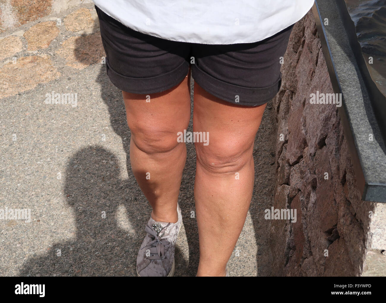 Die Beine der Frau in Shorts Stockfoto