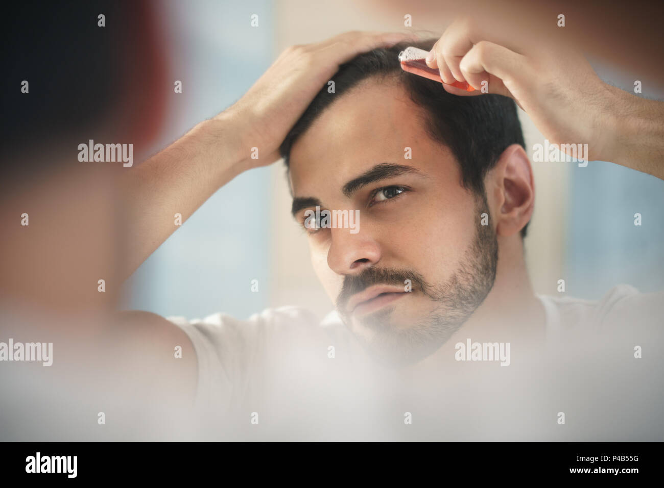 Weiß metrosexuellen Mann für Alopezie besorgt, die Lotion für die Haare wachsen. Junge Person zurücktretenhaarstrich auf Spiegel Stockfoto