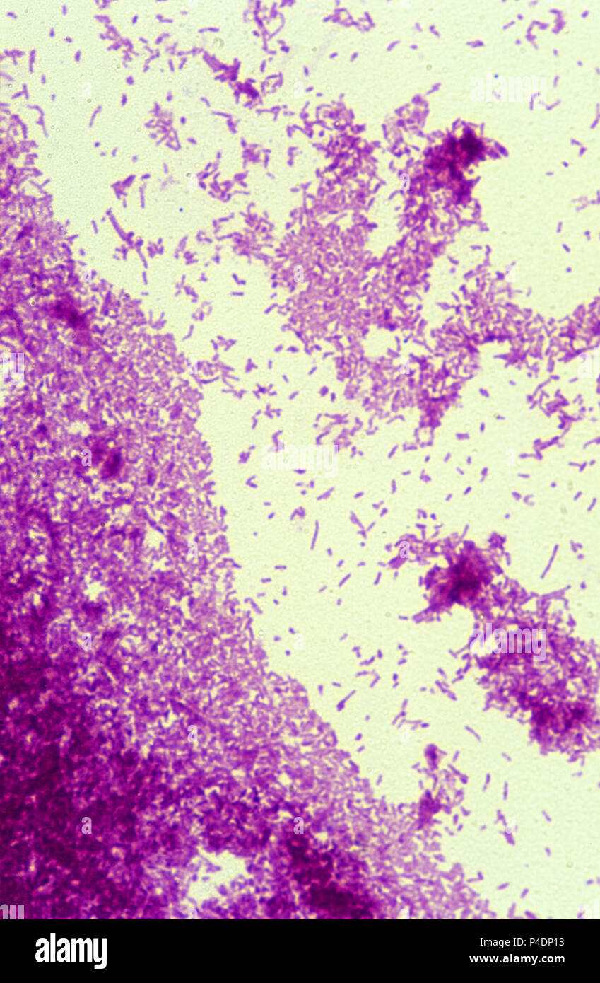 Mycobacterium-Tuberkulose-Bakterien Stockfoto