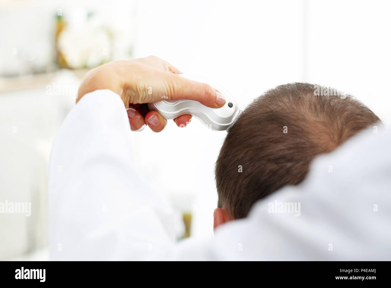 Alopezie. Trycholog. Haarausfall. Arzt. Der Kopf eines Mannes mit dünner werdendem Haar bei der Untersuchung der Kopfhaut und Haare mit einem Mikroskop Stockfoto