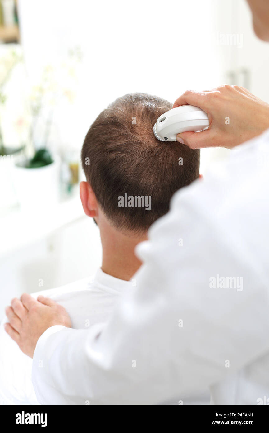 Alopezie. Trycholog. Haarausfall. Arzt. Der Kopf eines Mannes mit dünner werdendem Haar bei der Untersuchung der Kopfhaut und Haare mit einem Mikroskop Stockfoto