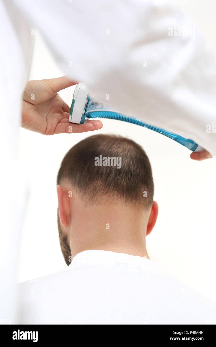 Laserbestrahlung der Kopfhaut. Pflege Behandlung für die Stärkung der Haarzwiebeln . Dermatologe. Behandlung gegen Haarausfall. Haarausfall bei Männern. Stockfoto