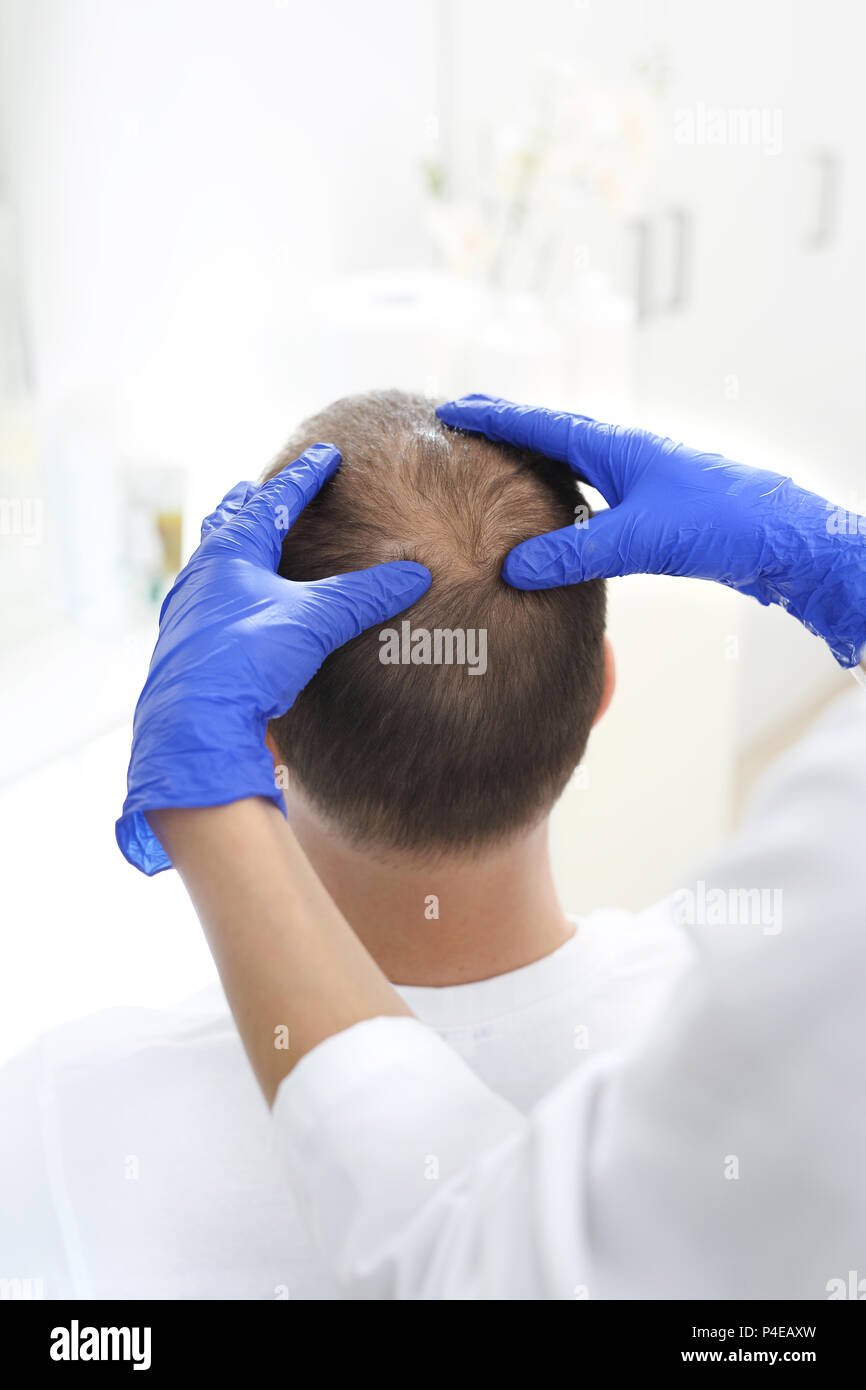 Entspannende Kopfmassage. Kopfmassage. Massieren Sie die Kopfhaut. Der Masseur massiert den Kopf des Mannes Stockfoto