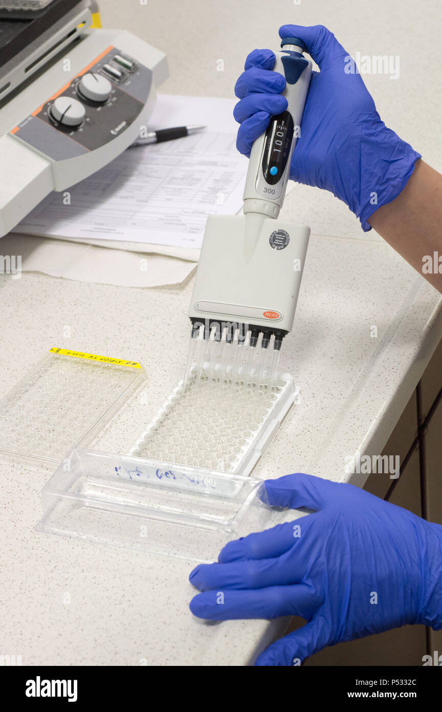 Die Arbeit im Labor: Vorbereitung der Proben innerhalb der ELISA-Diagnose Stockfoto