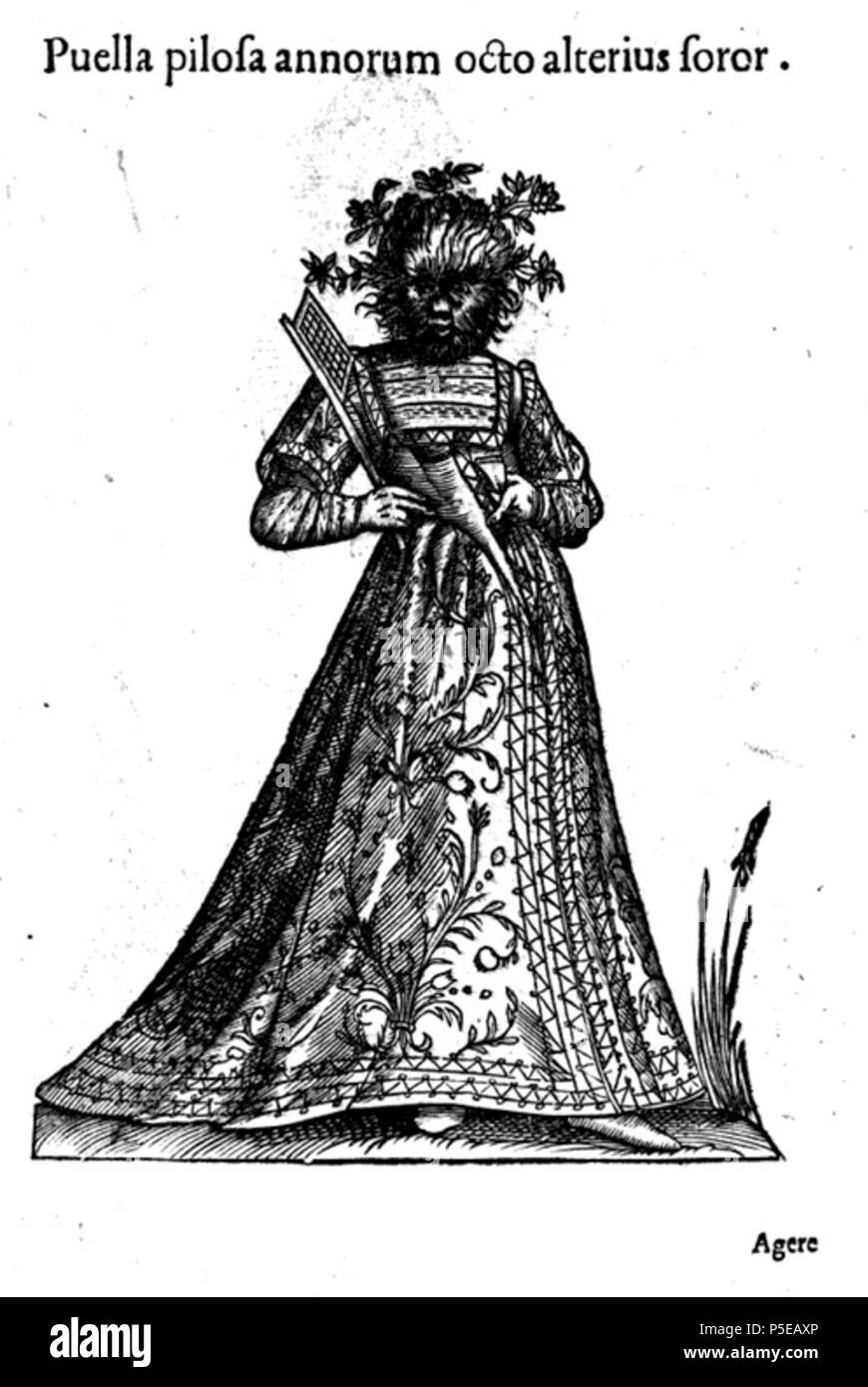 N/A. Français: Jeune fille poilue de Douze ans. Monstrorum historia d'Ulisse Androvandi, s. 17. 1642. Jean-Baptiste Coriolan 78 Aldrovandi-0018 Stockfoto