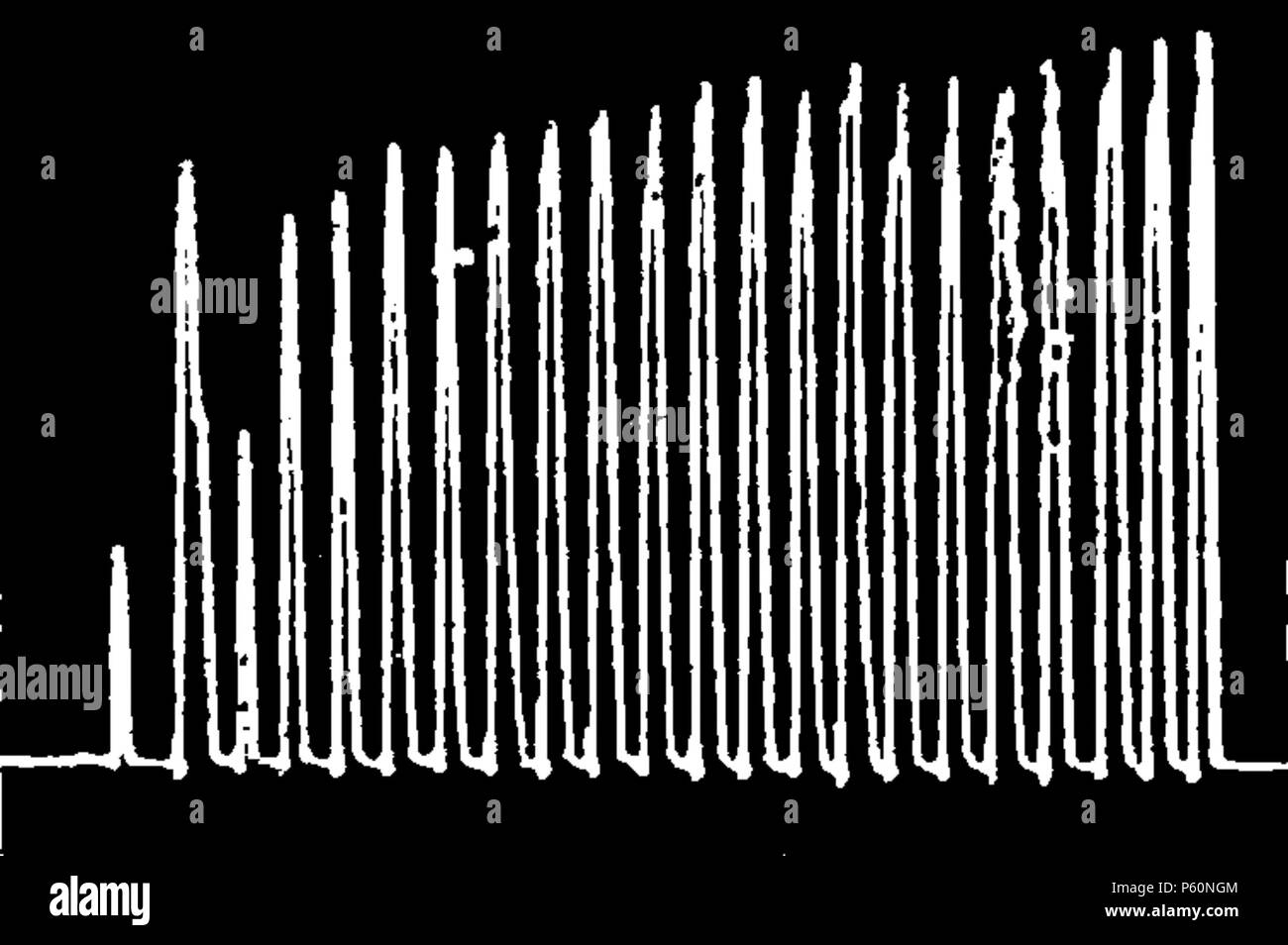 555 FI-d 187 - Abb. 68 - Courbe ergographique-femme Stockfoto