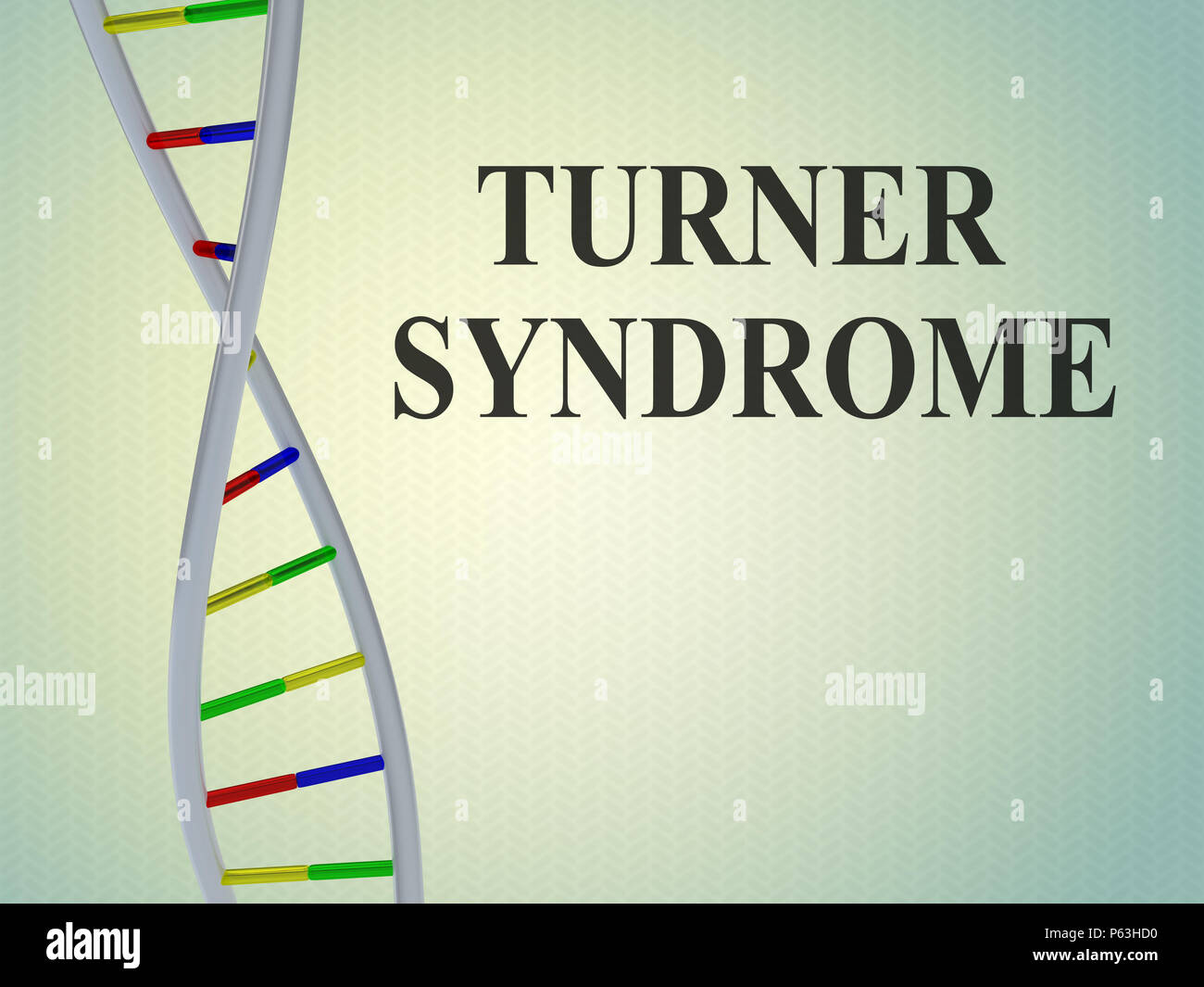 3D-Darstellung der Turner Syndrom Skript mit der Doppelhelix, auf farbigem Hintergrund. Stockfoto