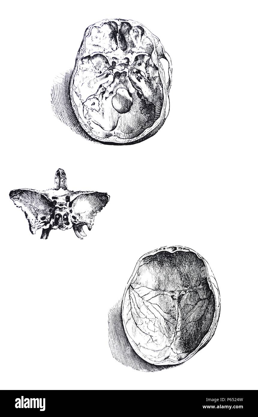 Die Platten aus dem ersten Buch der "De Humani Corporis Fabrica von Andreas Vesalius (1514-1564) Platte 7 - Der sechste Abbildung des sechsten Kapitel Freilegen der internen Aspekt der Basis der Schädelbasis zu sehen. Stockfoto