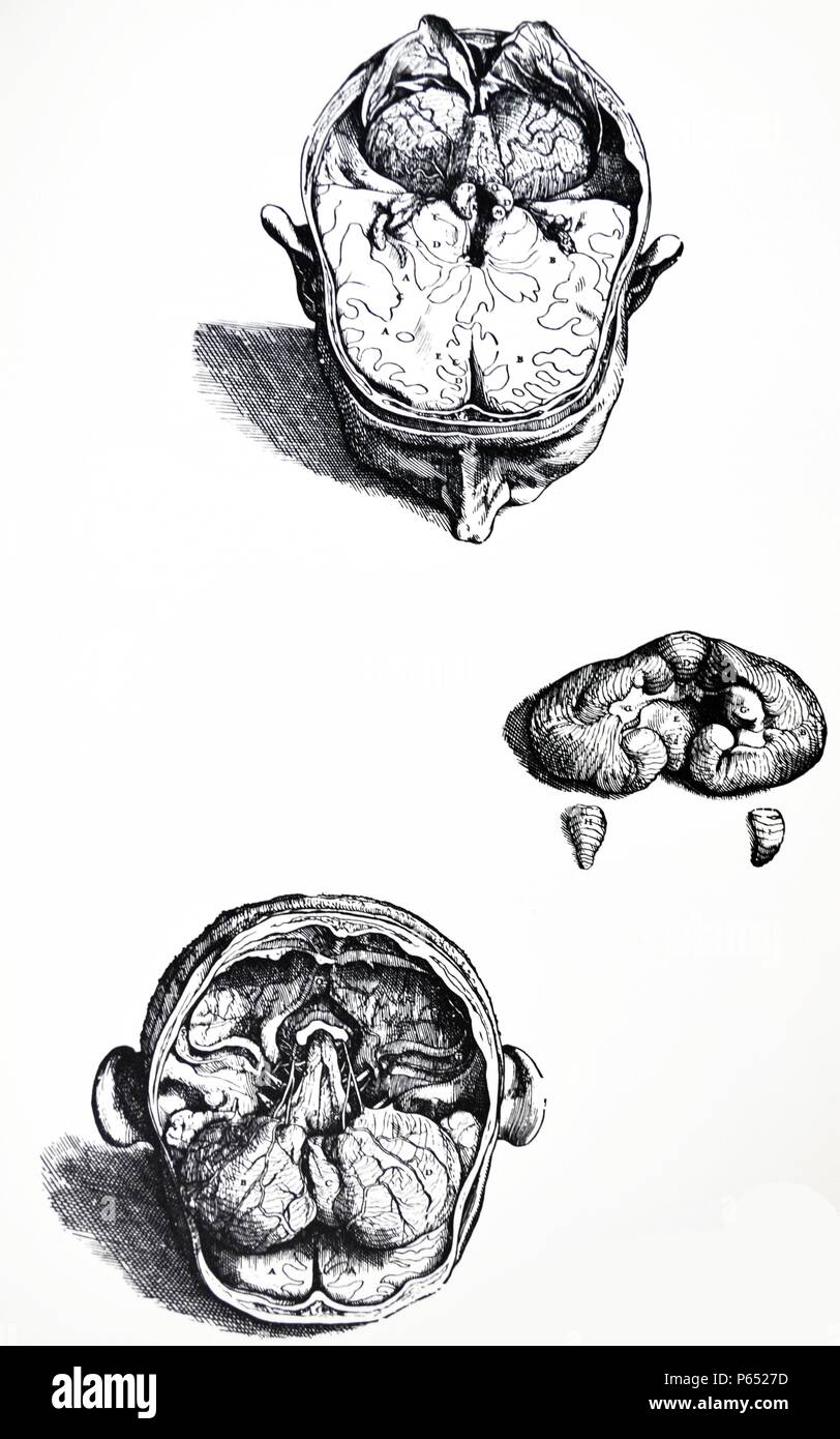 Die Platten aus dem 7. Buch der De Humani Corporis Fabrica von Andreas Vesalius (1514-1564) Platte 70 - Der achte Figur aus der 7. In dieser Hinsicht unterscheidet, dass wir hier Resezierten haben noch mehr des Gehirns und die Hoden des Gehirns durch einen langen Schnitt unterteilt, so dass der Durchgang vom dritten in den vierten Ventrikel aufgetreten ist. Stockfoto