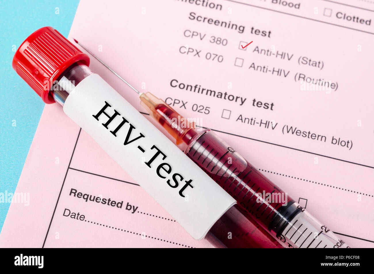 Blut Sammlung Probenröhrchen mit HIV Test Label auf HIV-Infektion screening Testform. Stockfoto