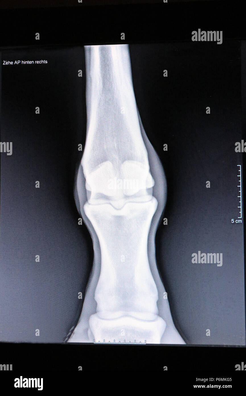 Melbeck, Röntgen Bild eines Fesselgelenk Stockfoto
