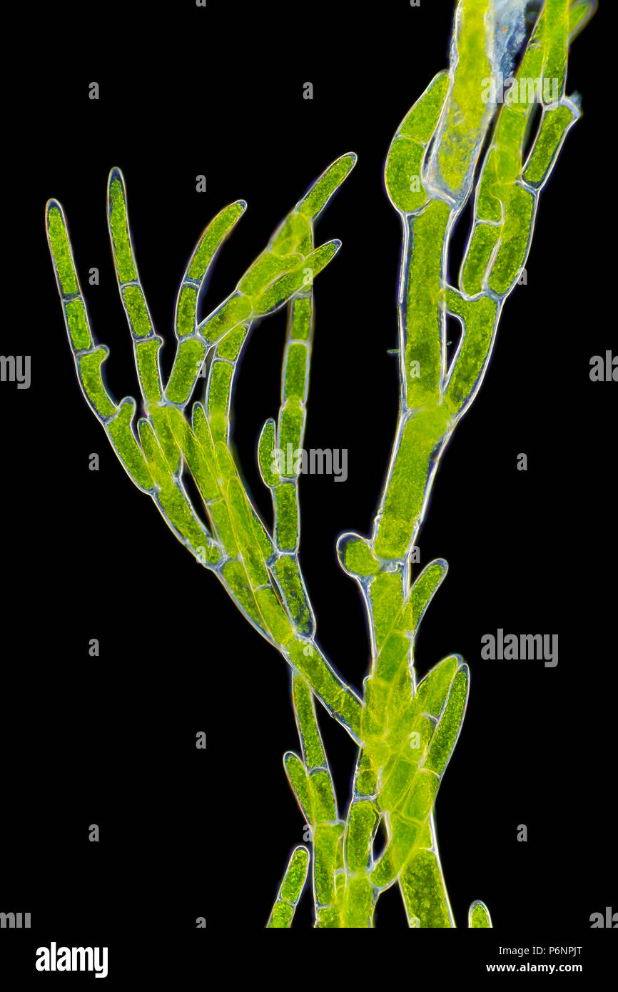 Mikroskopische Ansicht von grünen Algen (cladophora) Zweig. Darkfield Ablichtung. Stockfoto