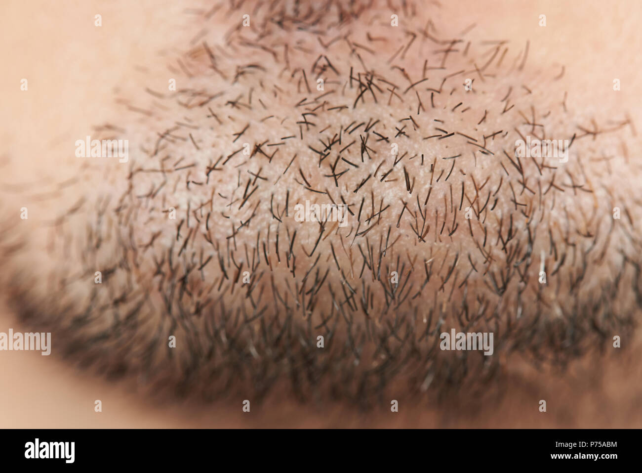 Schwarzes Haar des Menschen Bart am Kinn Nähe zu sehen. Stockfoto