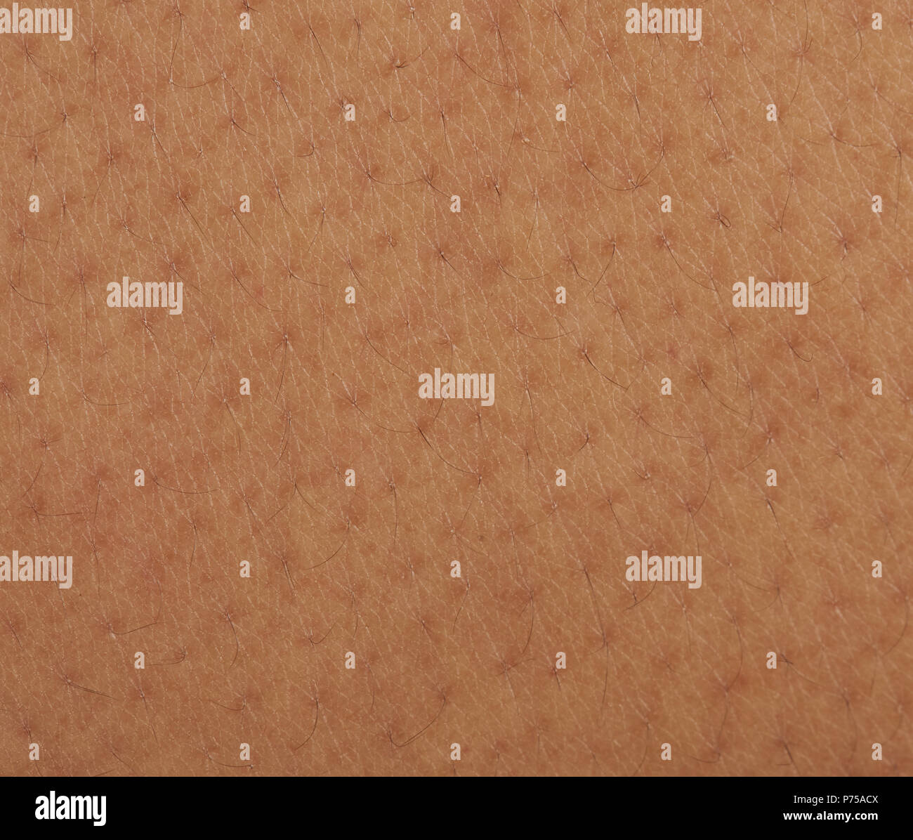 In der Nähe von dunklen Haut mit kleinen Haar. Dermatologie Thema Stockfoto