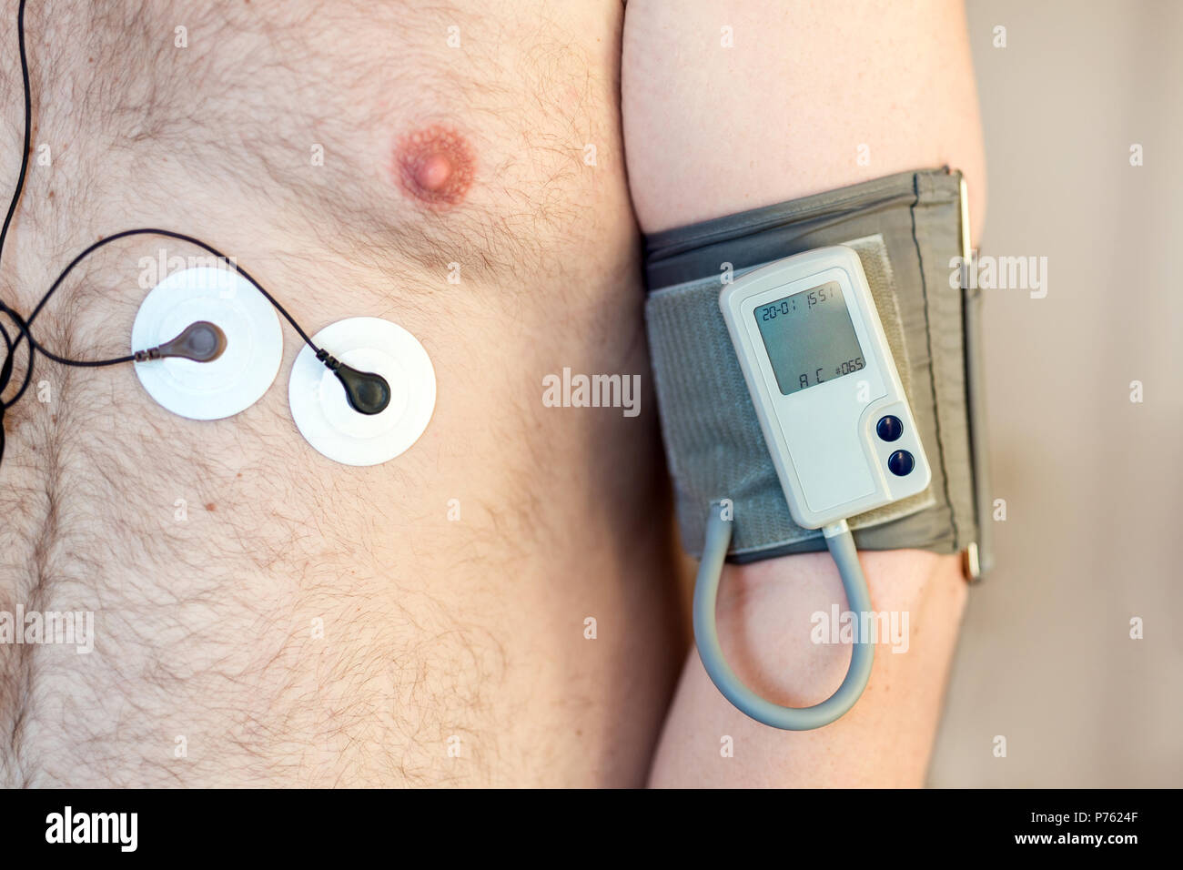 Holter Gerät überwachen und tägliche Blutdruck Recorder auf die menschliche Stockfoto