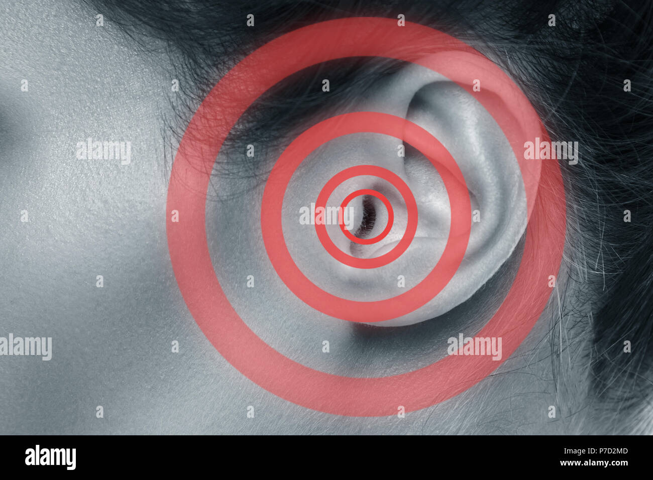 Weibliche Ohr mit Quelle von Schmerz. rote Markierung auf Monochrom Stockfoto