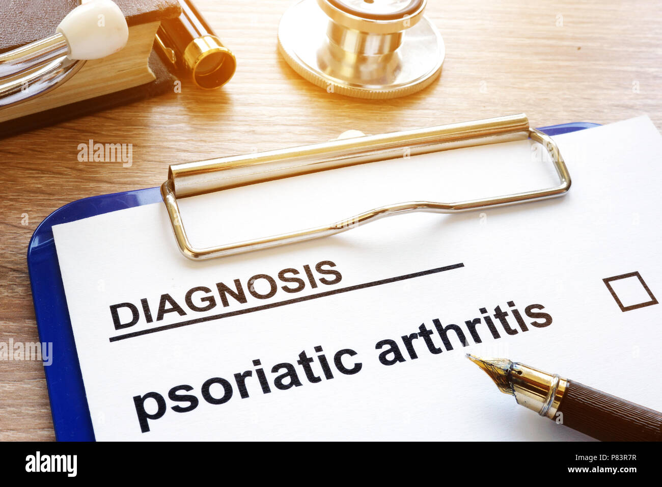 Diagnose Psoriasis Arthritis und Zwischenablage auf einen Schreibtisch. Stockfoto