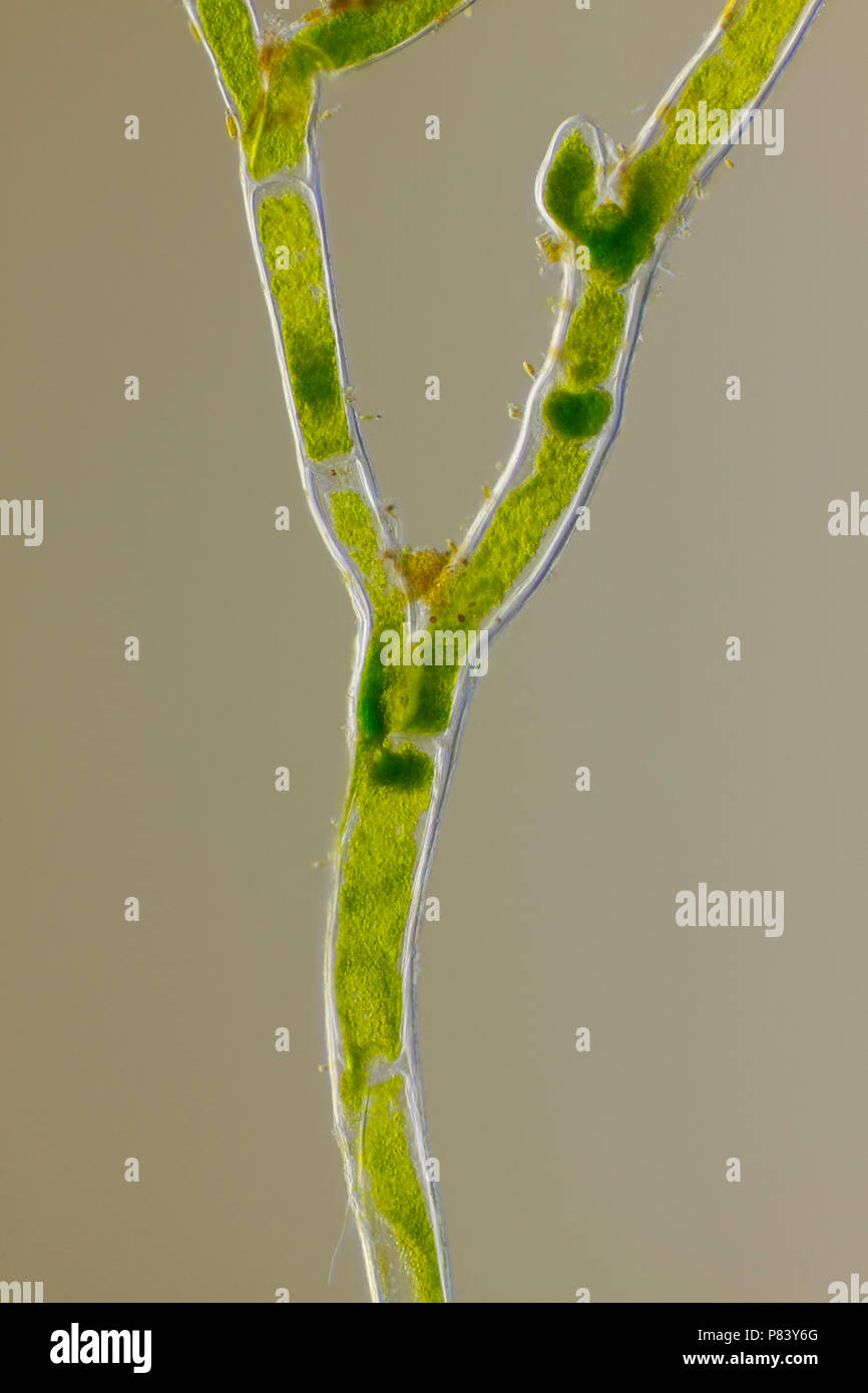 Mikroskopische Ansicht von grünen Algen (cladophora) Zweig verzweigt. Oblique Rheinberg Ausleuchtung. Stockfoto