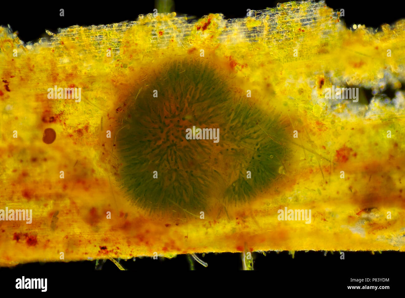 Sphärische Kolonie von Cyanobakterien (Gleotrichia, blau-grüne Algen). Blick von oben. Darkfield Ablichtung. Stockfoto