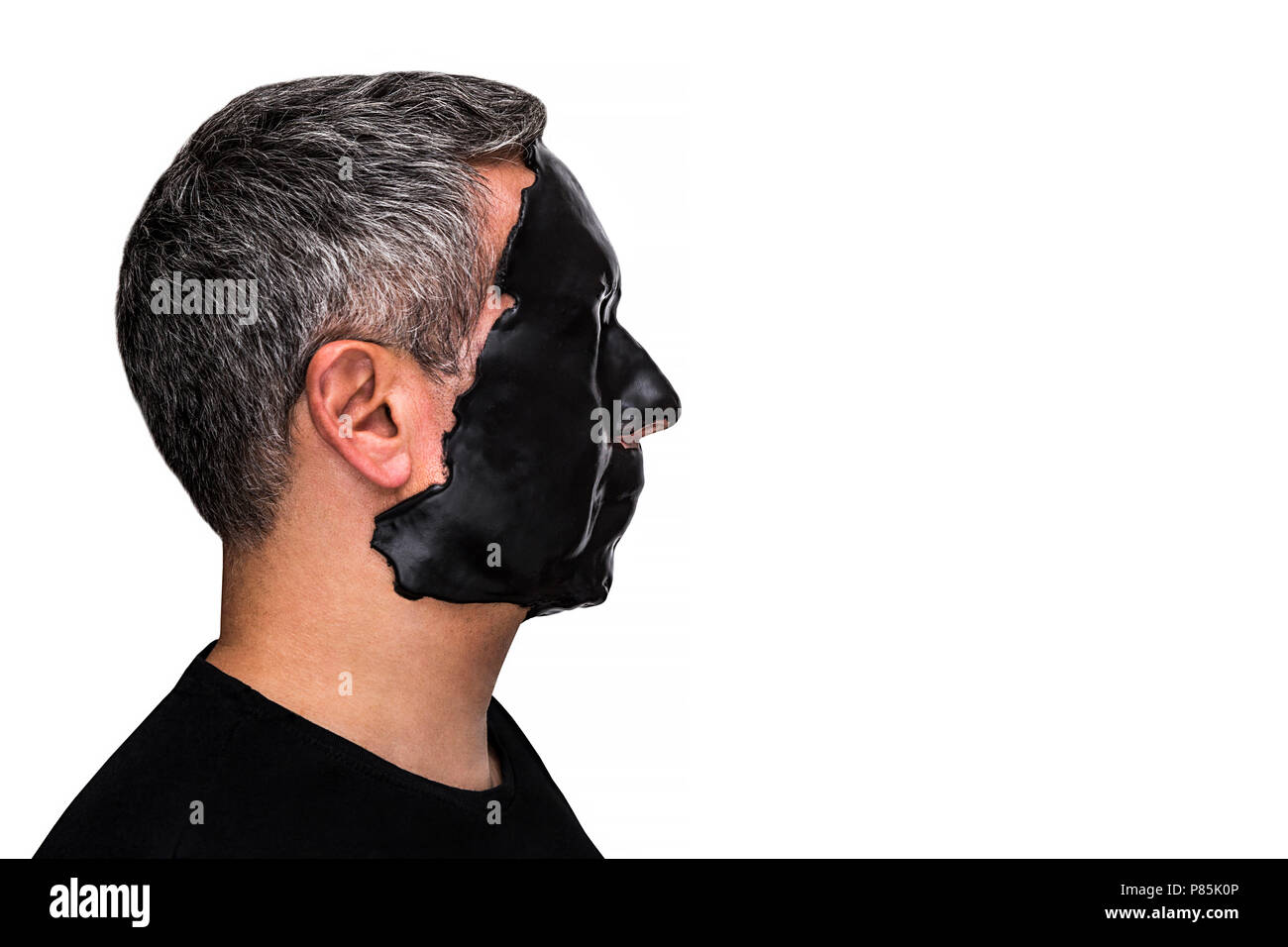 Männlichen Patienten mit Haut Alginat Meeresalgen schwarze Maske auf das Gesicht auf weißem Hintergrund. Stockfoto