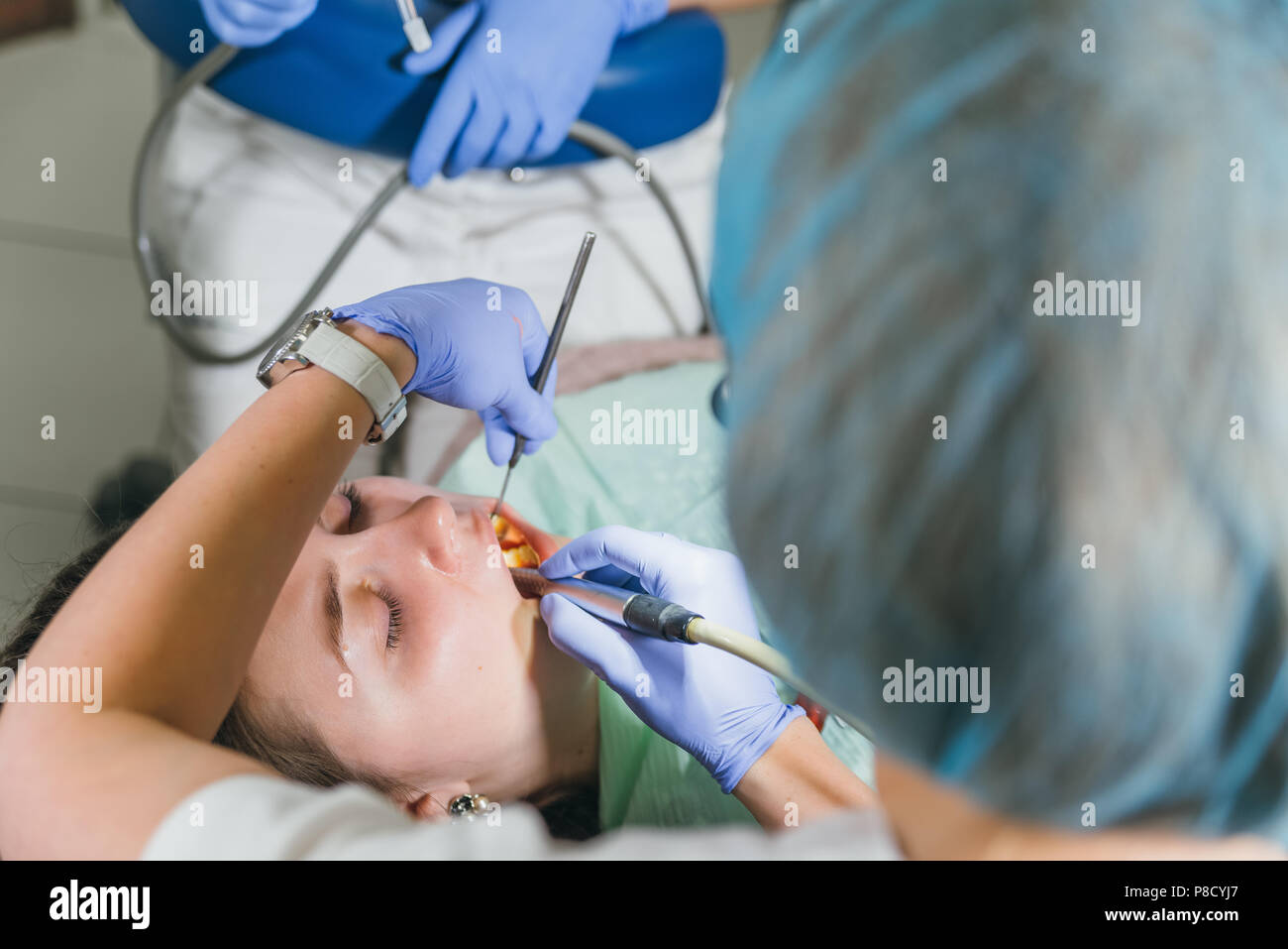 Frau beim Zahnarzt Klinik erhält der zahnmedizinischen Behandlung ein Loch in einen Zahn zu füllen. Zahnersatz und Verbundmaterial Polymerisation mit UV-Licht und Laser. Stockfoto