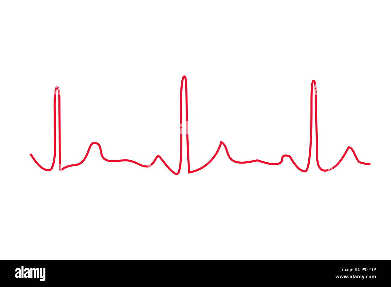 Elektrokardiogramm auf weißem Hintergrund. Herz-Impuls. Heartbeat Linie Abbildung Stockfoto