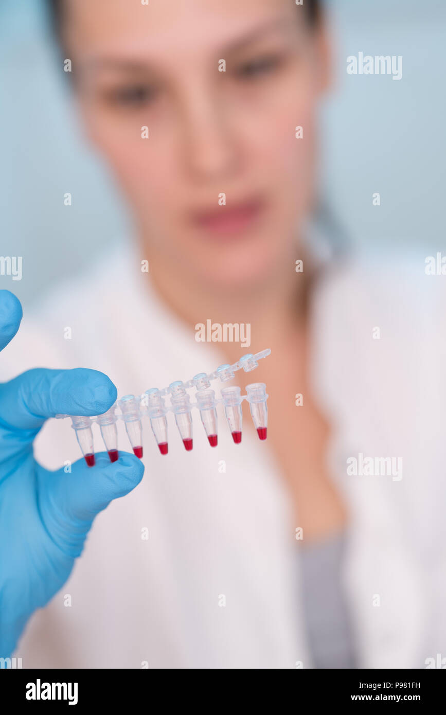 Junge Frau mit der genetischen Forschung im Labor Forschung von Krebserkrankungen Stockfoto