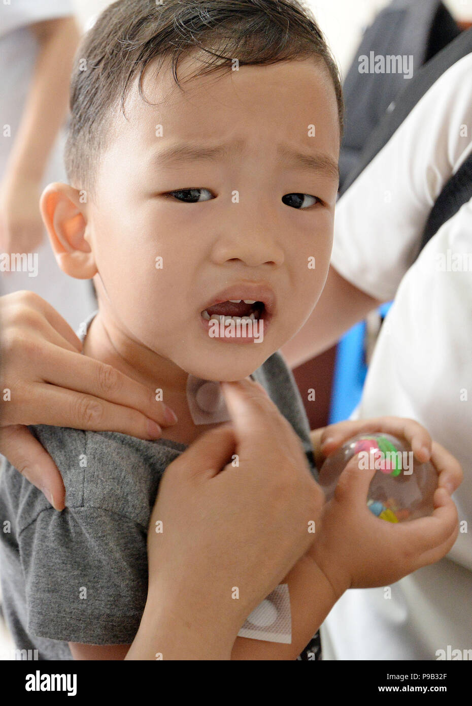 Juli 17, 2018 - Handan, Handan, China - Handan, CHINA - ist ein Kind mit  einem sanfutie Gips am Donnerstag in einem Krankenhaus für Chinesische  Medizin in Handan, nördlich der chinesischen Provinz