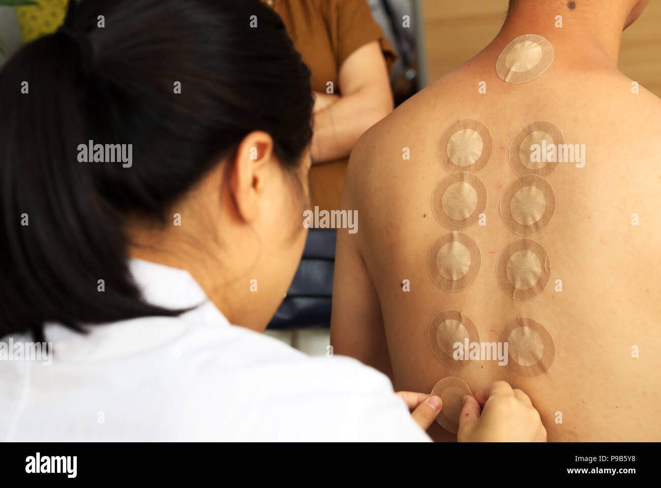 (180717) - chongqing, 17. Juli 2018 (Xinhua) - einen Arzt Praxis sanfutie Behandlung für einen Bürger in Chongqing, im Südwesten von China, 17. Juli 2018. Dienstag markiert den Beginn der sanfu, die zu den drei 10-tägigen Perioden, die prognostiziert werden die heißesten Tage des Jahres zu sein, bezieht. Sanfutie ist ein typischer Counter - Jahreszeit TCM-Behandlung, die Leckereien bei kaltem Wetter bedingte Krankheiten im heißen Sommer mit einem Verband aus traditionellen chinesischen Kräutermedizin auf verschiedenen Akupunkturpunkte am Körper platziert. (Xinhua / Yang Min) (Gni) Stockfoto