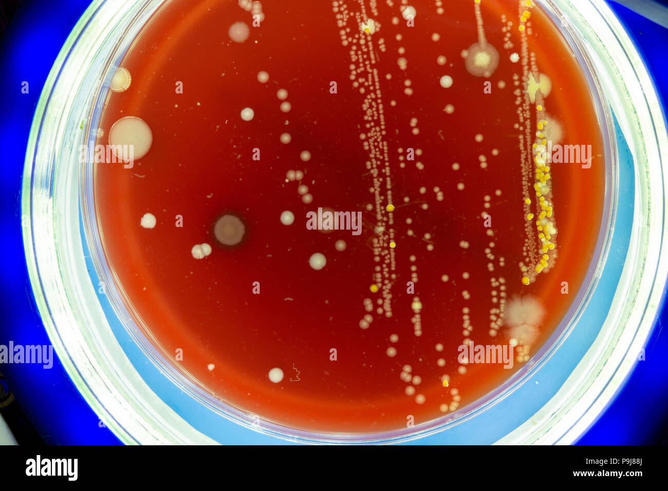 Petrischale mit Kolonien von Mikroben Stockfoto