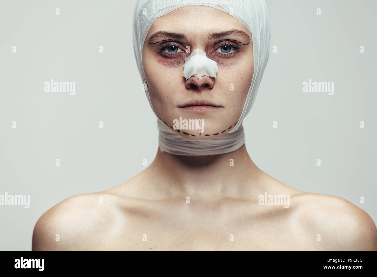 In der Nähe der jungen Frau in der medizinischen Bandagen nach Gesichtspflege kosmetische Chirurgie gewickelt. Weibliche Modell im Verband auf grauen Hintergrund. Stockfoto
