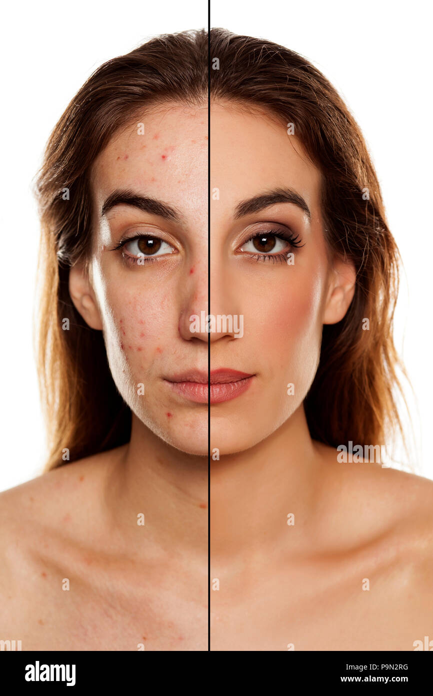 Comparition Porträt der gleichen Frau vor und nach der kosmetischen Behandlung amd Make-up auf weißem Hintergrund Stockfoto