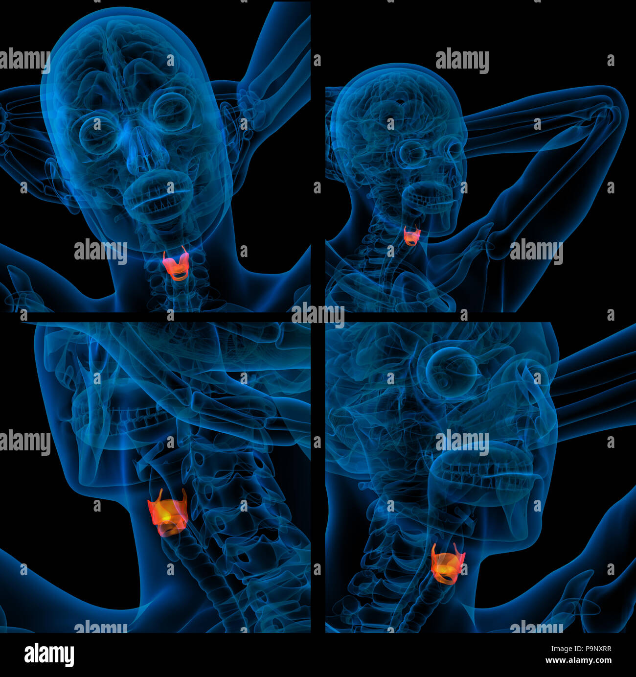 3D Rendering Illustration der Schilddrüse Stockfoto