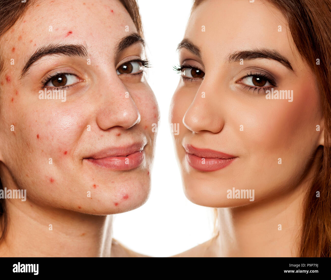 Vergleich Porträt der gleichen Frau vor und nach der kosmetischen Behandlung und Make-up auf weißem Hintergrund Stockfoto