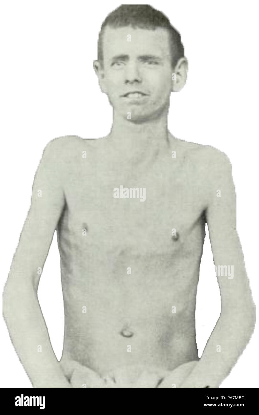 162 Asthenische 5 Stockfoto