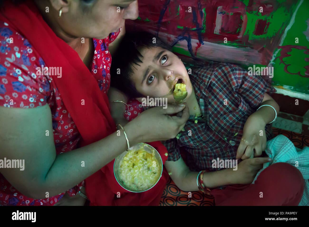 Behinderten Kindes an chingari Rehabilitationszentrum, Bhopal, Indien Stockfoto