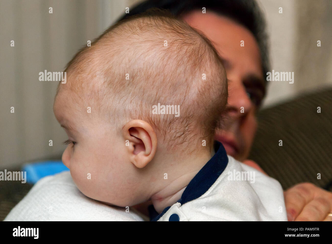 Schließen Sie herauf Bild eines Kindes mit einer möglichen Diagnose von Craniosynostosis. Er wird von seinem betroffenen Vater getröstet. Er tat es nicht. Stockfoto
