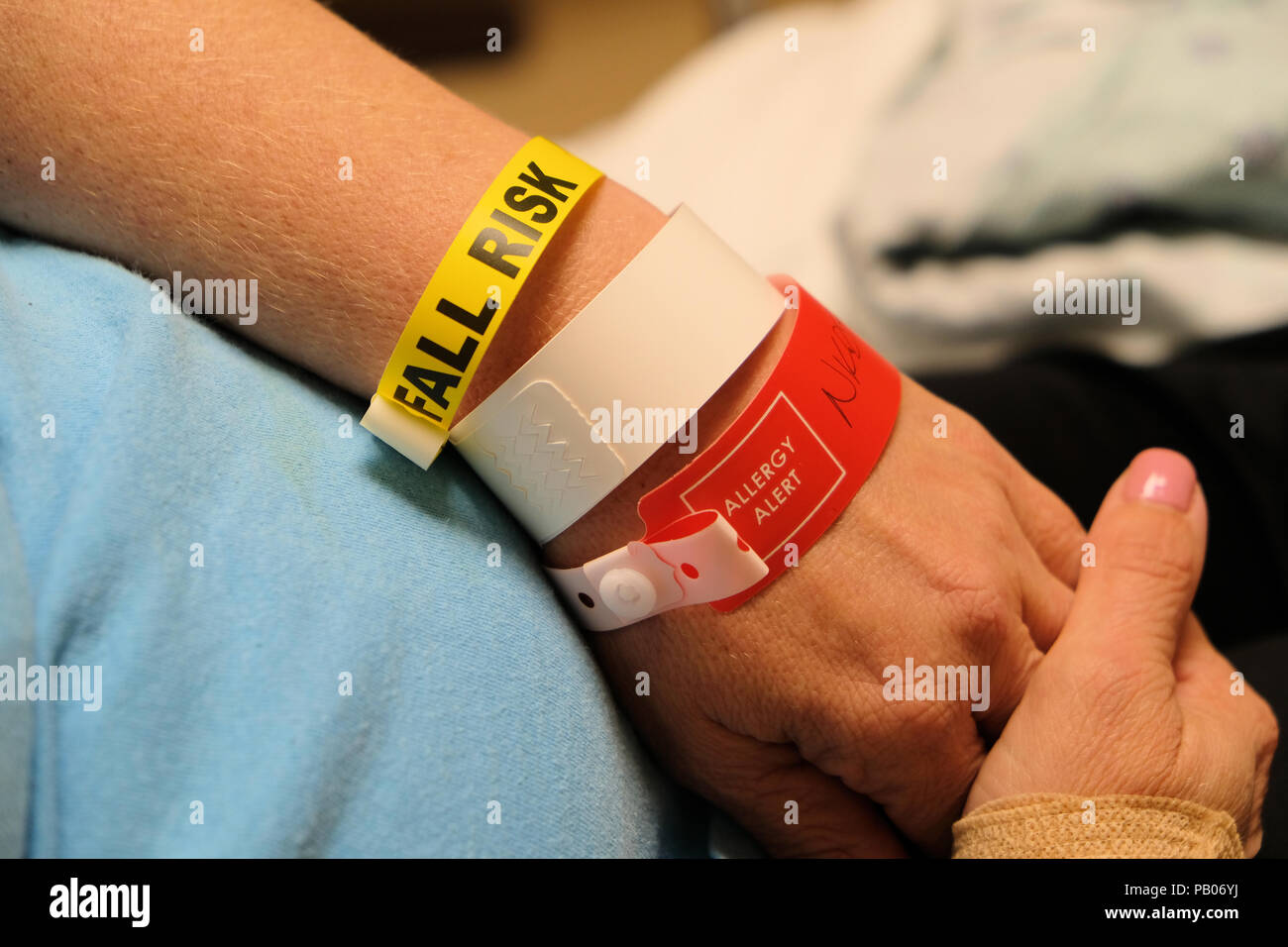 50-jährige Patientin mit Sturzrisiko und Allergie alert Armbänder erholt sich nach der Operation im Krankenhaus. Stockfoto