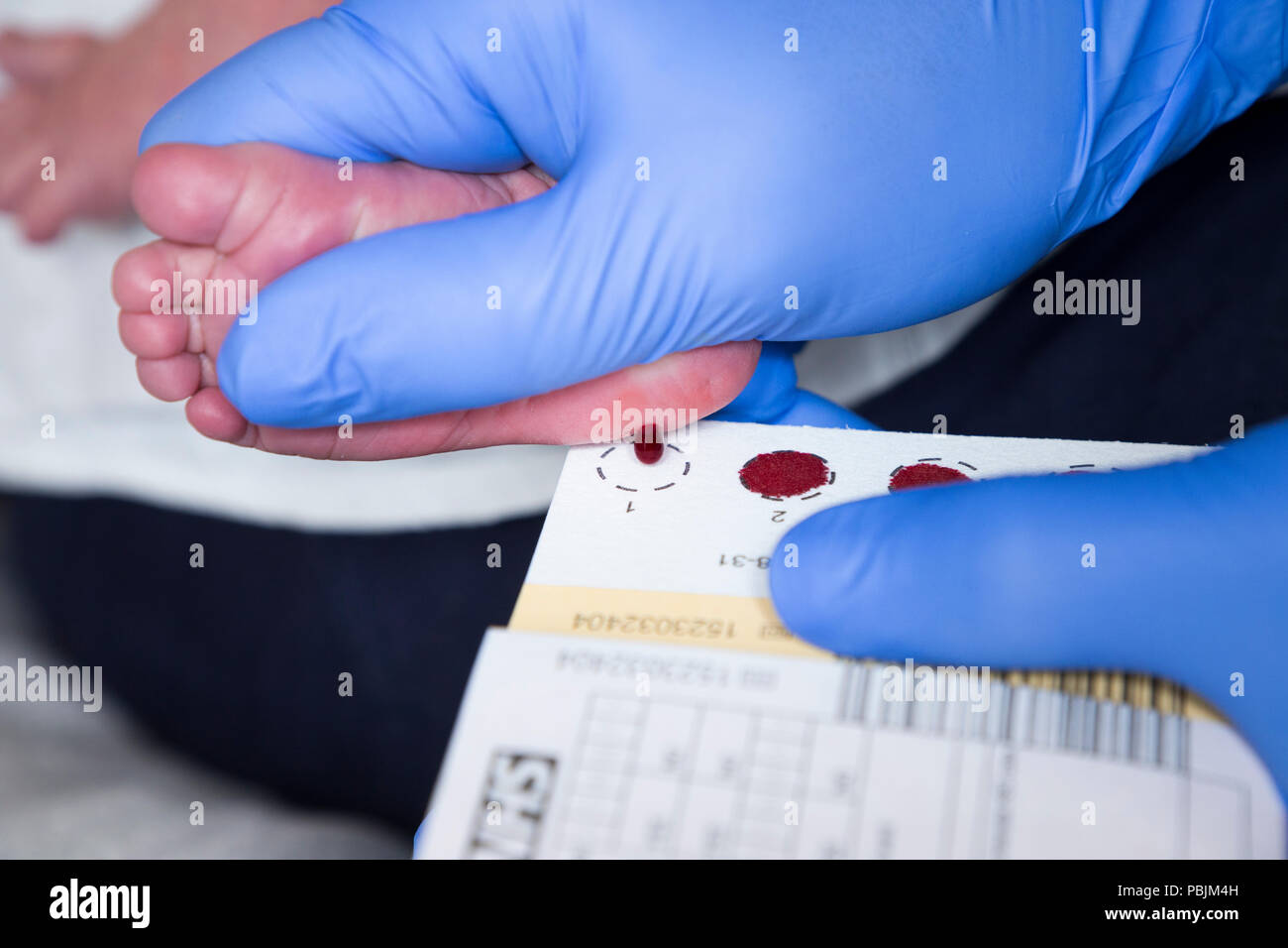 Neugeborene/New Born Baby durchläuft die neonatale Ferse stechen Screening" Guthrie Test', wo Blut sinkt Herbst/Blutstropfen auf einen Guthrie Karte fällt. Großbritannien (100) Stockfoto