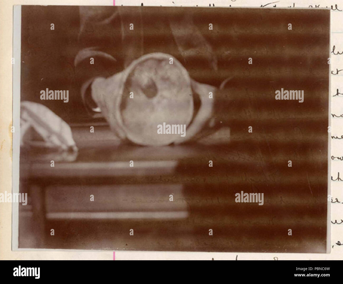 1015 Mendocino Autopsie Stockfoto