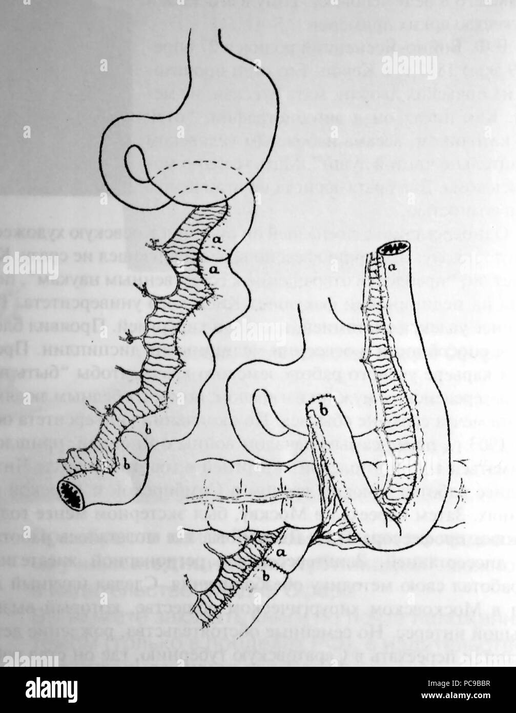 683 Операция Ру - Герцена Stockfoto
