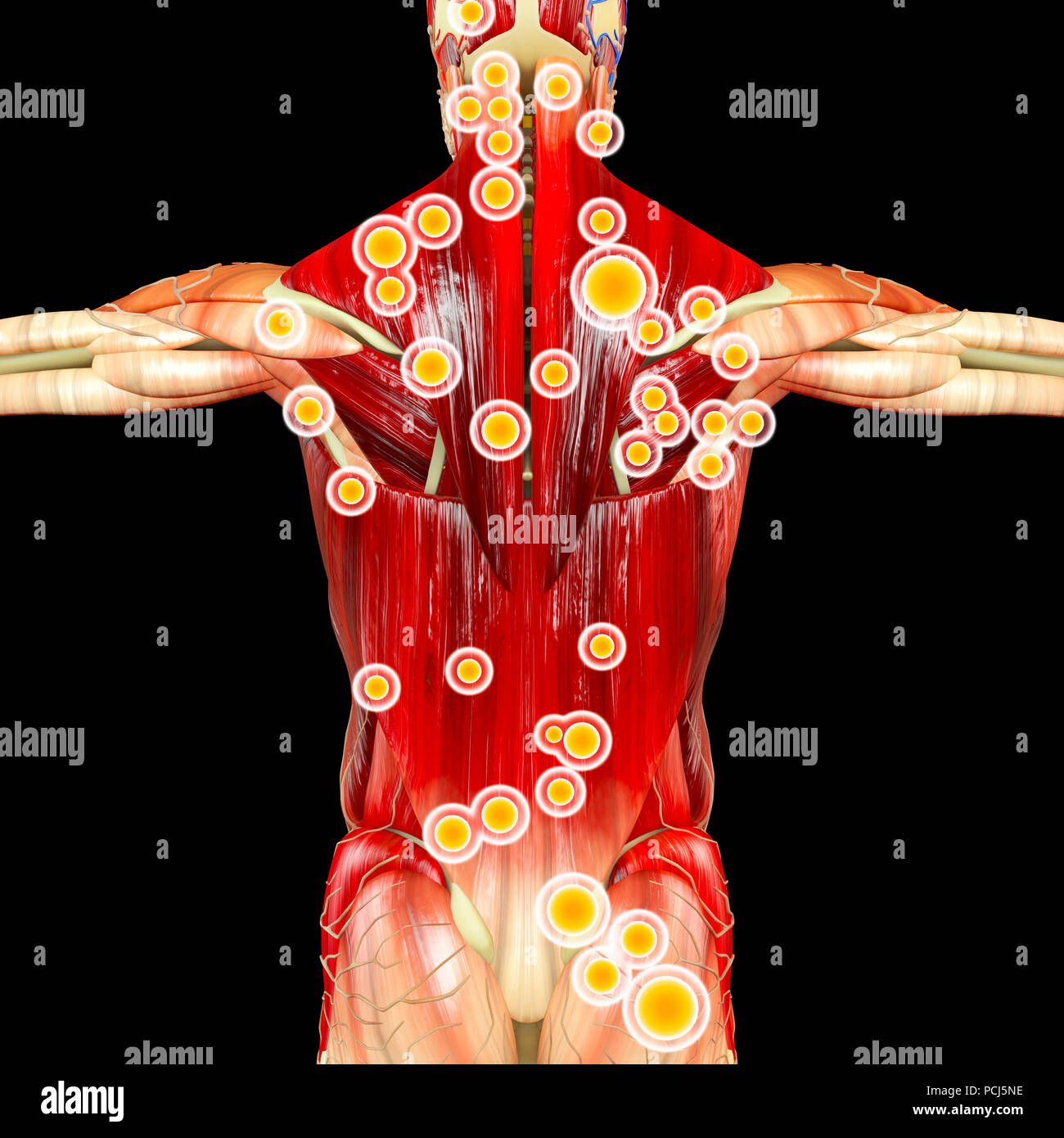 Zurück Blick auf einen Mann und seine Triggerpunkte. Anatomie Muskeln. 3D-Rendering. Myofasziale Triggerpunkte, werden als hyperirritable Spots beschrieben. Stockfoto