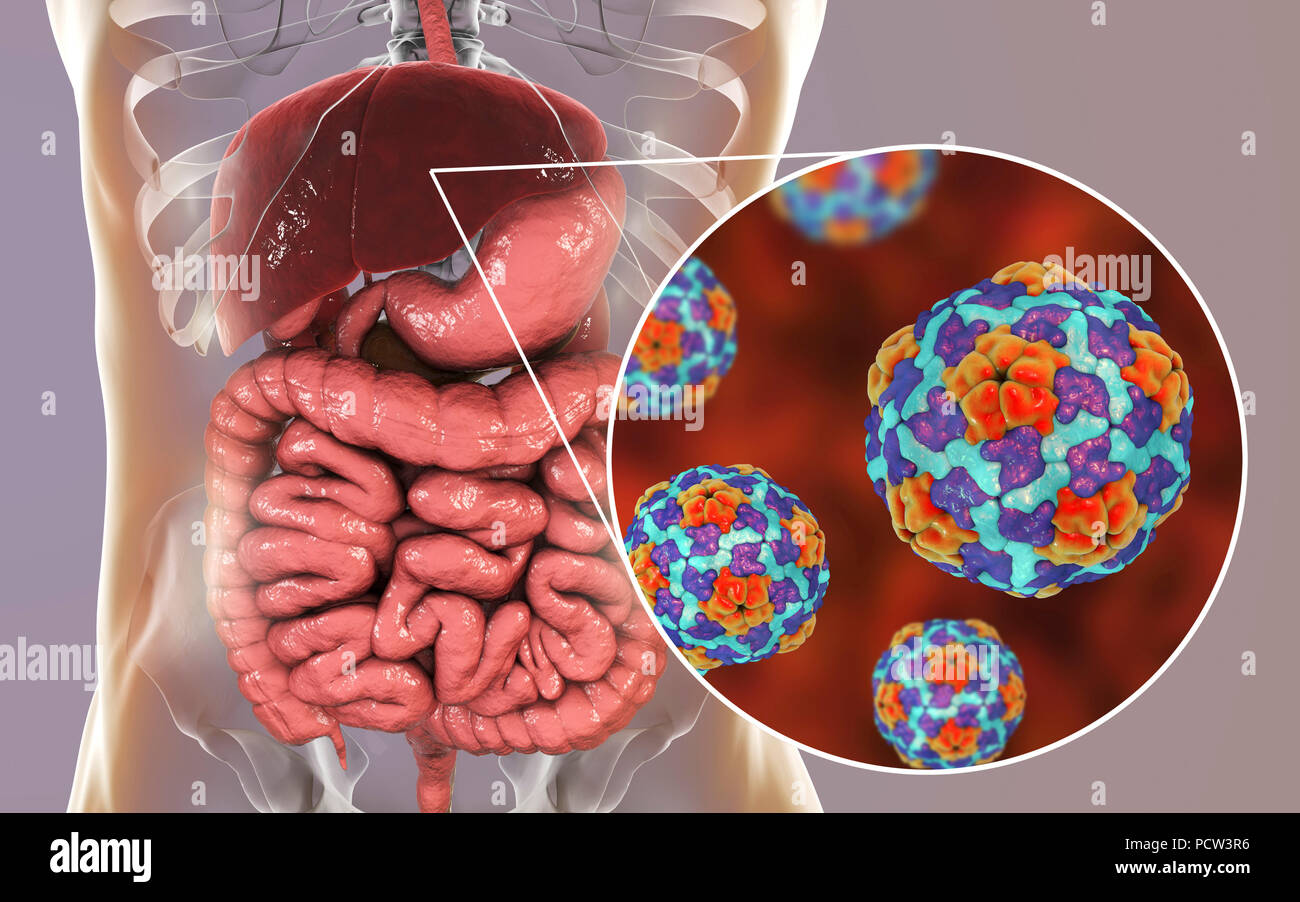Hepatitis-A-Infektion. Computer Abbildung Leber angezeigt und Nahaufnahme der Hepatitis-A-Viren. Stockfoto