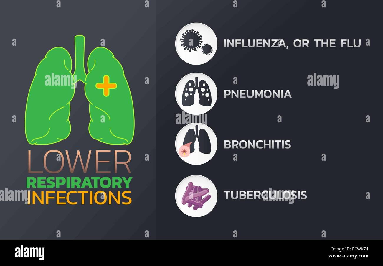 Infekte der unteren Atemwege Icon Design, infografik Gesundheit, medizinische Infografik. Vector Illustration Stock Vektor